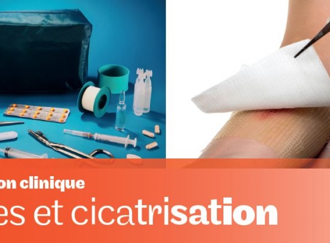 Le Cnam Pays de la Loire vous propose d'intégrer une formation clinique avec des professionnels experts en plaies et cicatrisation.